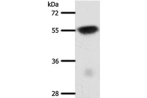 Western Blot analysis of Mouse brain tissue using SLC32A1 Polyclonal Antibody at dilution of 1:950 (SLC32A1 抗体)