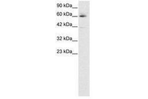 Image no. 3 for anti-Hematopoietic Cell-Specific Lyn Substrate 1 (HCLS1) (AA 28-77) antibody (ABIN6735791) (HCLS1 抗体  (AA 28-77))