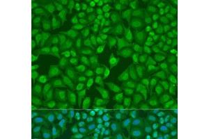 Immunofluorescence analysis of U2OS cells using MonoMethyl-UHRF1-K385 Polyclonal Antibody at dilution of 1:100.