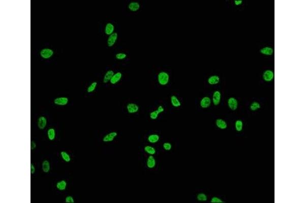 Recombinant HIST1H2BB 抗体  (acLys20)