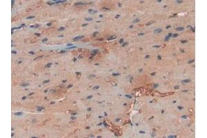 DAB staining on IHC-P; Samples: Human Heart Tissue (Haptoglobin 抗体  (AA 70-332))