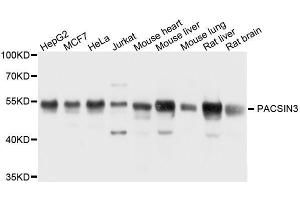 Western Blotting (WB) image for anti-Protein Kinase C and Casein Kinase Substrate in Neurons 3 (PACSIN3) (AA 175-424) antibody (ABIN6145159)