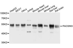 Western blot analysis of extracts of various cell lines, using PACSIN3 antibody. (PACSIN3 抗体  (AA 175-424))