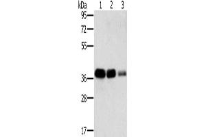 Gel: 8 % SDS-PAGE, Lysate: 40 μg, Lane 1-3: A549 cells, HT29 cells, A172 cells, Primary antibody: ABIN7130292(MTFR1 Antibody) at dilution 1/500, Secondary antibody: Goat anti rabbit IgG at 1/8000 dilution, Exposure time: 5 seconds (MTFR1 抗体)