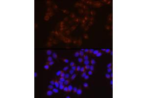 Immunofluorescence analysis of HeLa cells using LDL Receptor (LDLR) Rabbit mAb  at dilution of 1:150 (40x lens). (LDLR 抗体)