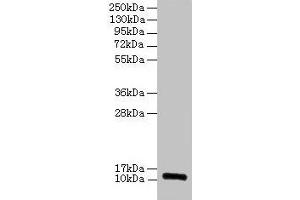 Western blot All lanes: RPLP1 antibody at 2 μg/mL Lane 1: EC109 whole cell lysate Lane 2: 293T whole cell lysate Secondary Goat polyclonal to rabbit IgG at 1/15000 dilution Predicted band size: 12, 9 kDa Observed band size: 12 kDa (RPLP1 抗体  (AA 2-114))