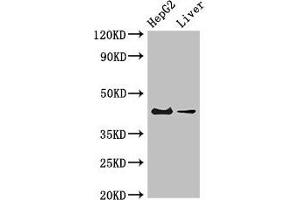 Western Blot Positive WB detected in: HepG2 whole cell lysate, Mouse liver tissue All lanes: GPER1 antibody at 4 μg/mL Secondary Goat polyclonal to rabbit IgG at 1/50000 dilution Predicted band size: 43 kDa Observed band size: 43 kDa (Mesothelin 抗体  (AA 1-62))