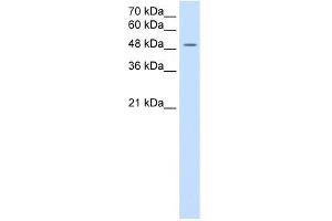 SLC16A8 antibody used at 2. (MCT3 抗体)