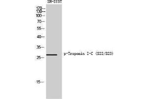 Western Blotting (WB) image for anti-Cardiac Troponin C (TNNC1) (pSer22), (pSer23) antibody (ABIN3182561) (TNNC1 抗体  (pSer22, pSer23))