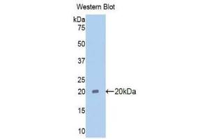 Western Blotting (WB) image for anti-Pim-1 Oncogene (PIM1) (AA 38-177) antibody (ABIN1078444) (PIM1 抗体  (AA 38-177))