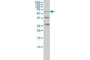 RIOK3 monoclonal antibody (M02), clone 3G11 Western Blot analysis of RIOK3 expression in K-562 . (RIOK3 抗体  (AA 411-516))