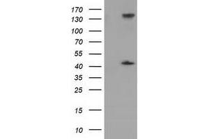 Western Blotting (WB) image for anti-phosphoribosylaminoimidazole Carboxylase, phosphoribosylaminoimidazole Succinocarboxamide Synthetase (PAICS) antibody (ABIN1500021) (PAICS 抗体)