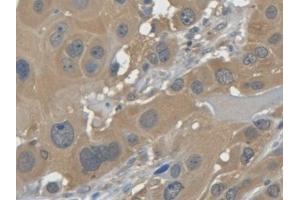 Immunohistochemistry (IHC) image for anti-Galectin 7 (LGALS7) (AA 1-136) antibody (ABIN7426955)