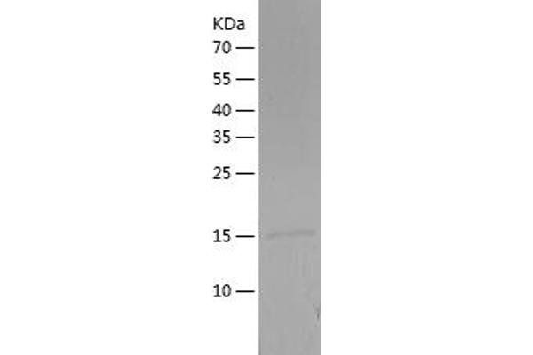 CST3 Protein (AA 29-148) (His tag)