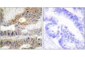 Immunohistochemistry (IHC) image for anti-Tumor Necrosis Factor Receptor Superfamily, Member 6b, Decoy (TNFRSF6B) (AA 251-300) antibody (ABIN1533564)