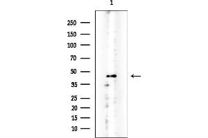 anti-Translocation Associated Membrane Protein 1 (TRAM1) antibody