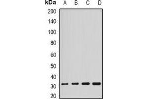 Western blot analysis of SCO2 expression in HL60 (A), SKOV3 (B), mouse brain (C), rat liver (D) whole cell lysates. (SCO2 抗体)