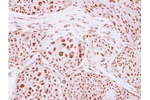 Image no. 1 for anti-General Transcription Factor IIIC, Polypeptide 4 (GTF3C4) (AA 73-334) antibody (ABIN1498564) (GTF3C4 抗体  (AA 73-334))
