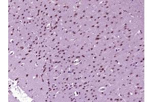 Paraformaldehyde-fixed, paraffin embedded Mouse brain Antigen retrieval by boiling in sodium citrate buffer (pH6.