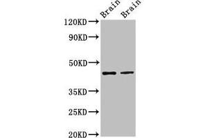 Western Blot Positive WB detected in: Rat brain tissue, Mouse brain tissue All lanes: MAPK3 antibody at 3 μg/mL Secondary Goat polyclonal to rabbit IgG at 1/50000 dilution Predicted band size: 44, 39, 41 kDa Observed band size: 44 kDa (ERK1 抗体  (AA 11-379))