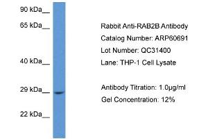 Western Blotting (WB) image for anti-RAB2B, Member RAS Oncogene Family (RAB2B) (C-Term) antibody (ABIN786243) (RAB2B 抗体  (C-Term))