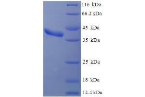 SDS-PAGE (SDS) image for Chloride Channel Calcium Activated 2 (CLCA2) (AA 1-235), (full length) protein (His-SUMO Tag) (ABIN5709291) (CLCA2 Protein (AA 1-235, full length) (His-SUMO Tag))