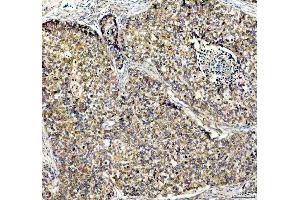 IHC analysis of PDK2 using anti-PDK2 antibody (ABIN5693279).