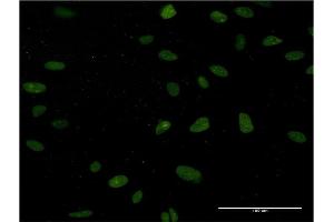 Immunofluorescence of monoclonal antibody to NUCKS1 on HeLa cell. (NUCKS1 抗体  (AA 1-243))