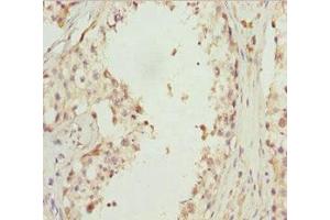 Immunohistochemistry of paraffin-embedded human testis tissue using ABIN7151422 at dilution of 1:100 (EFHC1 抗体  (AA 391-640))