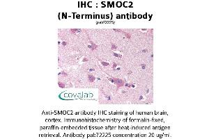 Image no. 1 for anti-SPARC Related Modular Calcium Binding 2 (SMOC2) antibody (ABIN1739464)