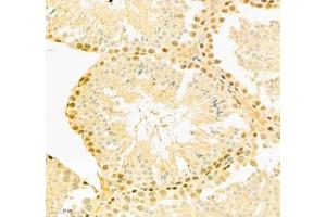 Immunohistochemistry of paraffin embedded mouse testis using COMMD4 (ABIN7073559) at dilution of 1: 800 (300x lens) (COMMD4 抗体)