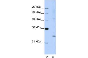 Western Blotting (WB) image for anti-Exosome Component 4 (EXOSC4) antibody (ABIN2462286) (EXOSC4 抗体)