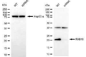 Western blotting analysis using RAB10 antibody (ABIN7800087).