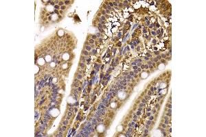 Immunohistochemistry of paraffin-embedded mouse ileum using CLASP1 antibody at dilution of 1:100 (x400 lens). (CLASP1 抗体)