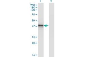 Western Blot analysis of B3GAT3 expression in transfected 293T cell line by B3GAT3 monoclonal antibody (M02), clone 1C11. (B3GAT3 抗体  (AA 236-335))