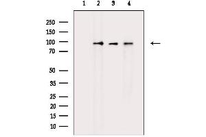 anti-Transforming Growth Factor, beta Receptor III (TGFBR3) (C-Term) antibody