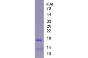 SDS-PAGE of Protein Standard from the Kit (Highly purified E. (LIPC ELISA 试剂盒)