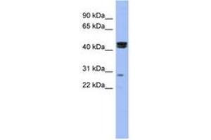 Image no. 1 for anti-Heat Shock Transcription Factor, Y-Linked 1 (HSFY1) (N-Term) antibody (ABIN6742900)