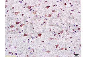 Formalin-fixed and paraffin embedded: rat brain tissue labeled with Anti-CaMK2b Polyclonal Antibody (ABIN669876), Unconjugated at 1:200 followed by conjugation to the secondary antibody and DAB staining (CAMK2B 抗体  (AA 1-100))