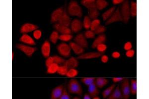 Immunofluorescence analysis of HeLa cells using PIDD Polyclonal Antibody at dilution of 1:100 (40x lens). (PIDD 抗体)