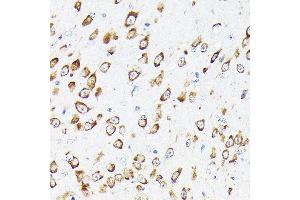 Immunohistochemistry of paraffin-embedded mouse brain using eEF1G Rabbit pAb (ABIN6133514, ABIN6139951, ABIN6139952 and ABIN6223877) at dilution of 1:50 (40x lens).