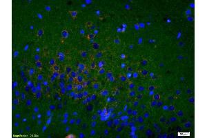 Formalin-fixed and paraffin embedded rat brain labeled with Rabbit Anti Sigma1R/OPRS1/Sigma Receptor Polyclonal Antibody, Unconjugated (ABIN709841) at 1:200, overnight at 4°C. (SIGMAR1 抗体  (AA 21-120))