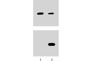 Human Endothelial cells were either untreated (left column) or treated with (right column) IL-4 (10 ng/ml) for 1 hour at 37°C. (STAT6 抗体  (pTyr641))