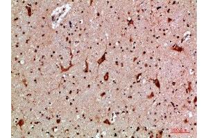 Immunohistochemical analysis of paraffin-embedded human-brain, antibody was diluted at 1:200 (MBL2 抗体  (AA 21-70))
