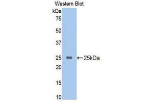 Western Blotting (WB) image for anti-Cytochrome P450, Family 2, Subfamily E, Polypeptide 1 (CYP2E1) (AA 126-309) antibody (ABIN1174041)