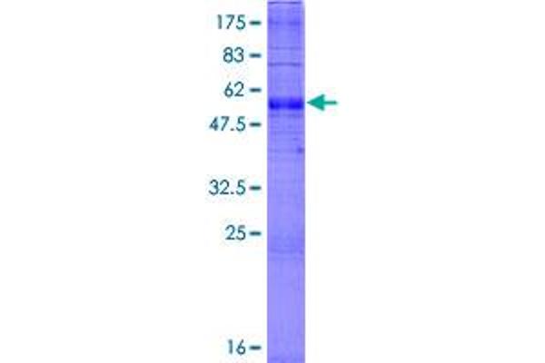 SLC35A1 Protein (AA 1-337) (GST tag)