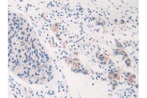 Used in DAB staining on fromalin fixed paraffin- embedded prostate gland cancer tissue (GALC 抗体  (AA 375-535))