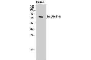 Western Blotting (WB) image for anti-Proto-oncogene tyrosine-protein kinase Src (Src) (Tyr1161) antibody (ABIN3184111) (Src 抗体  (Tyr1161))