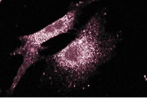 Immunofluorescence staining of NIH/3T3 cells (Mouse embryo fibroblast cells, ATCC CRL-1658). (SLC9A1 抗体  (AA 682-801))