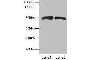 Western blot All lanes: AZIN1 antibody at 4 μg/mL Lane 1: Mouse liver tissue Lane 2: PC-3 whole cell lysate Secondary Goat polyclonal to rabbit IgG at 1/10000 dilution Predicted band size: 50 kDa Observed band size: 50 kDa (Antizyme Inhibitor 1 抗体  (AA 101-400))
